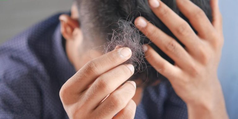 Does Hair Spray Cause Hair Loss? Unveiling the Truth Behind This Common Product