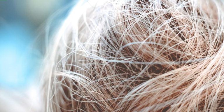 Does Lack of Sleep Cause Hair Loss? Unveiling the Truth Behind This Common Question