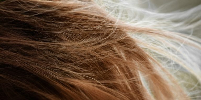 Health Conditions That Cause Hair Loss: Unveiling the Hidden Facts